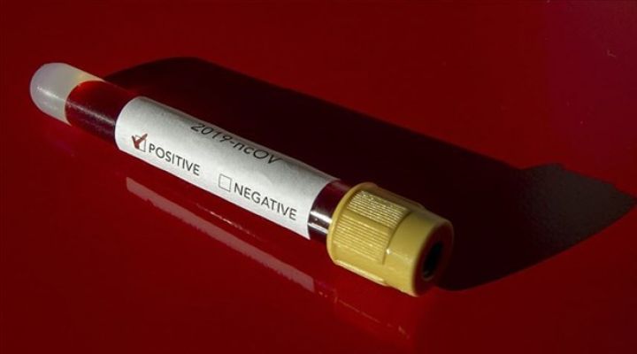 Azərbaycanda koronavirusdan növbəti ölümlər var - SON MƏLUMAT