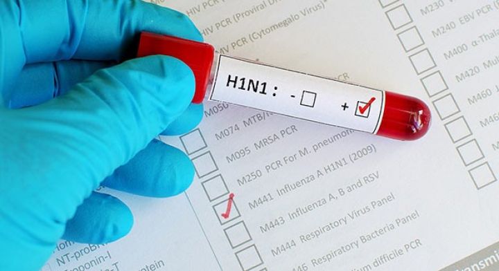 Gürcüstanda iki nəfərin “donuz qripi”ndən ölməsi təsdiqlənib