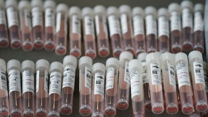 Azərbaycanda koronavirus ilə bağlı son vəziyyət açıqlandı