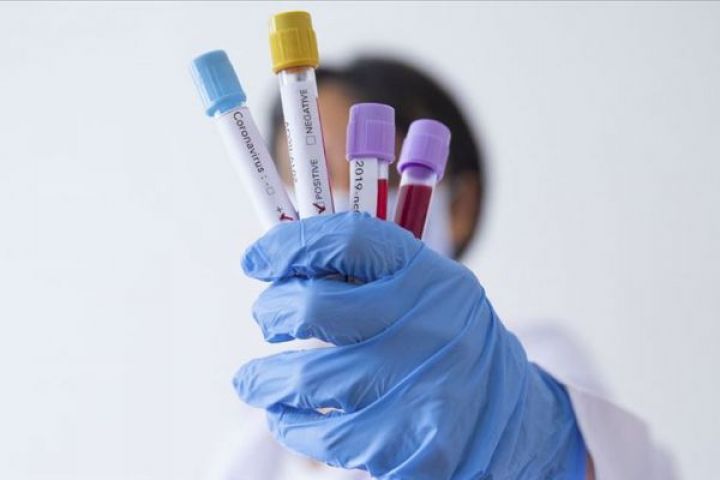 Azərbaycanda koronavirus ilə bağlı son vəziyyət açıqlandı