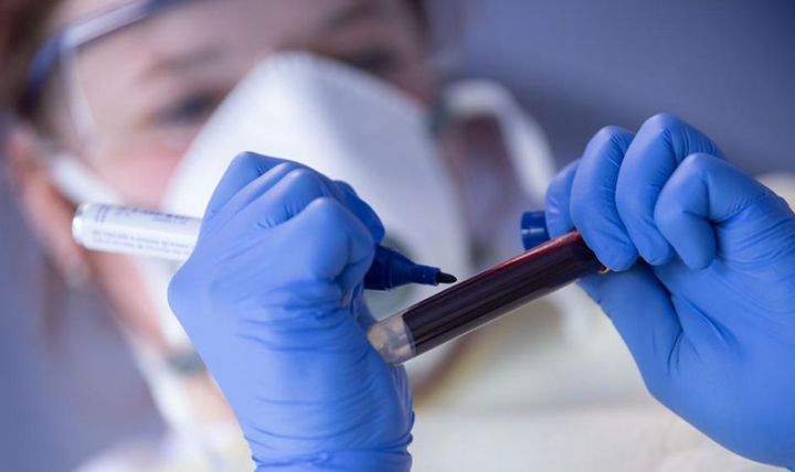 Azərbaycanda koronavirus ilə bağlı son vəziyyət açıqlandı